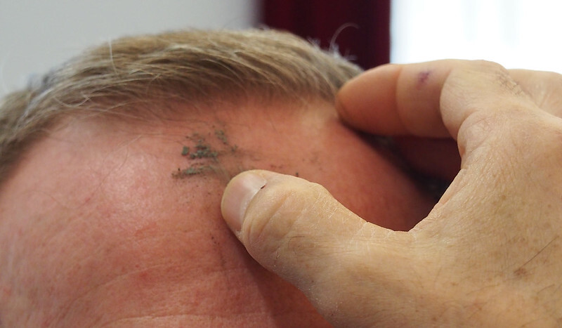 Erteilung des Aschenkreuzes