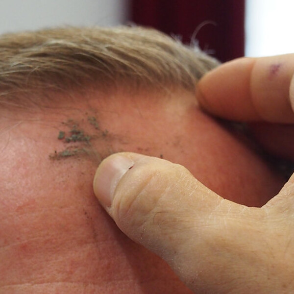 Erteilung des Aschenkreuzes