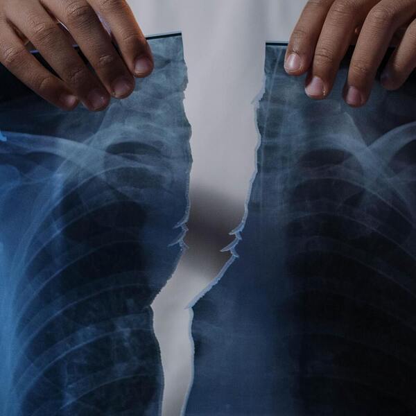Röntgenbilder